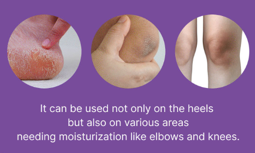 Baren Shea Butter Sleeping Heel Patch - noční náplasti na paty s bambuckým máslem 10 kusů (1)